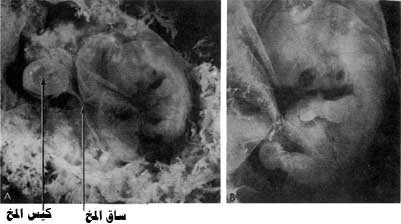 اضغط على الصورة لعرض أكبر. 

الإسم:	image.png 
مشاهدات:	73 
الحجم:	86.1 كيلوبايت 
الهوية:	812206
