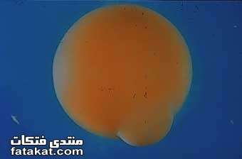 اضغط على الصورة لعرض أكبر. 

الإسم:	image.png 
مشاهدات:	67 
الحجم:	51.5 كيلوبايت 
الهوية:	812221