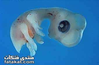 اضغط على الصورة لعرض أكبر. 

الإسم:	image.png 
مشاهدات:	67 
الحجم:	81.0 كيلوبايت 
الهوية:	812226