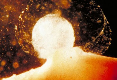 اضغط على الصورة لعرض أكبر. 

الإسم:	ovulation-and-fertility-s2-moment-of-ovulation.jpg 
مشاهدات:	73 
الحجم:	40.4 كيلوبايت 
الهوية:	832430