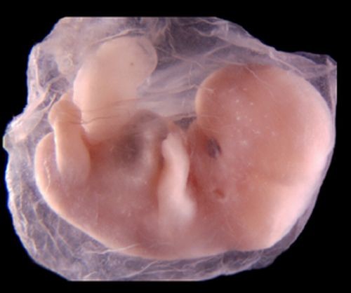 اضغط على الصورة لعرض أكبر. 

الإسم:	embryo_human_003.jpg 
مشاهدات:	13 
الحجم:	28.9 كيلوبايت 
الهوية:	843455