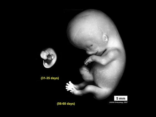 اضغط على الصورة لعرض أكبر. 

الإسم:	embryo_human_004.jpg 
مشاهدات:	13 
الحجم:	15.7 كيلوبايت 
الهوية:	843456