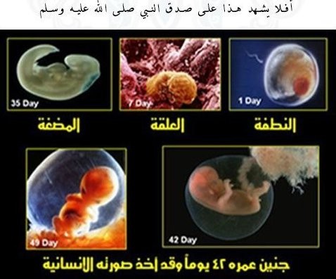 اضغط على الصورة لعرض أكبر. 

الإسم:	gNrvoMZ.jpg 
مشاهدات:	10 
الحجم:	45.9 كيلوبايت 
الهوية:	849491